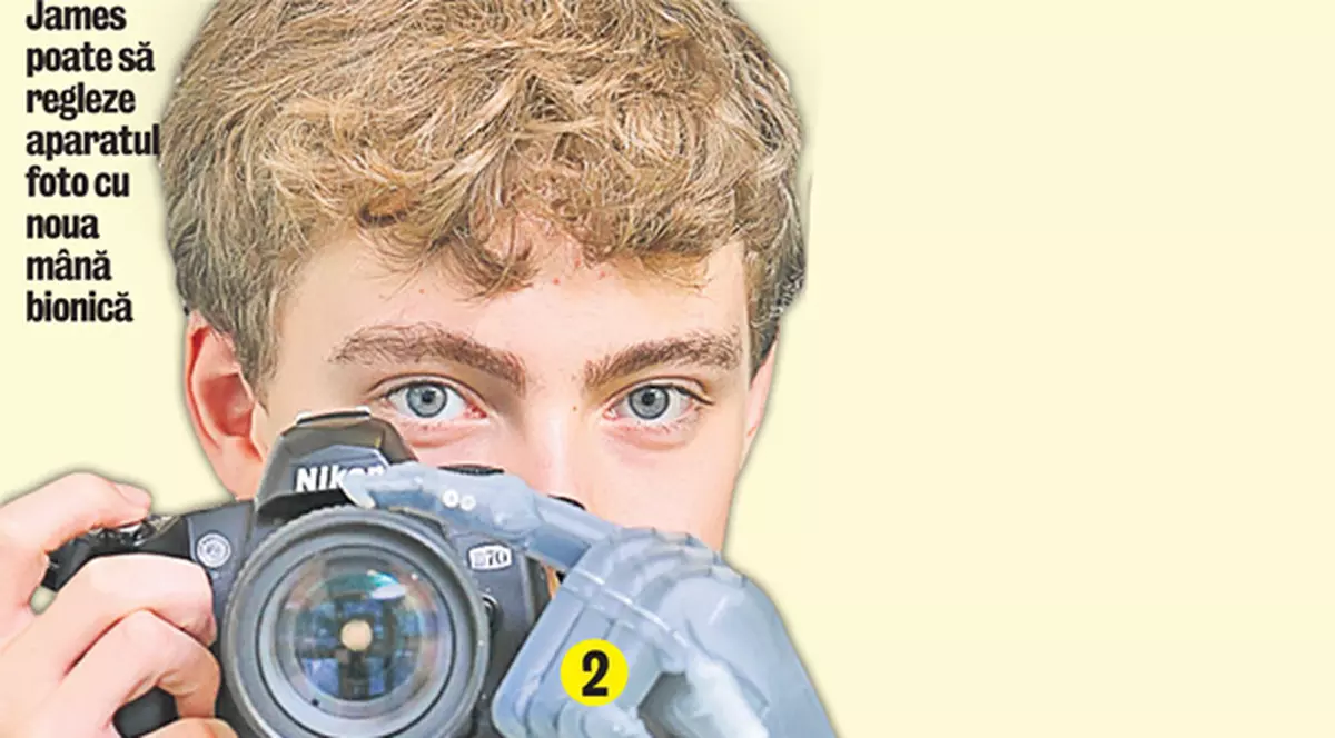 Un adolescent a primit o mână bionică de la Mercedes