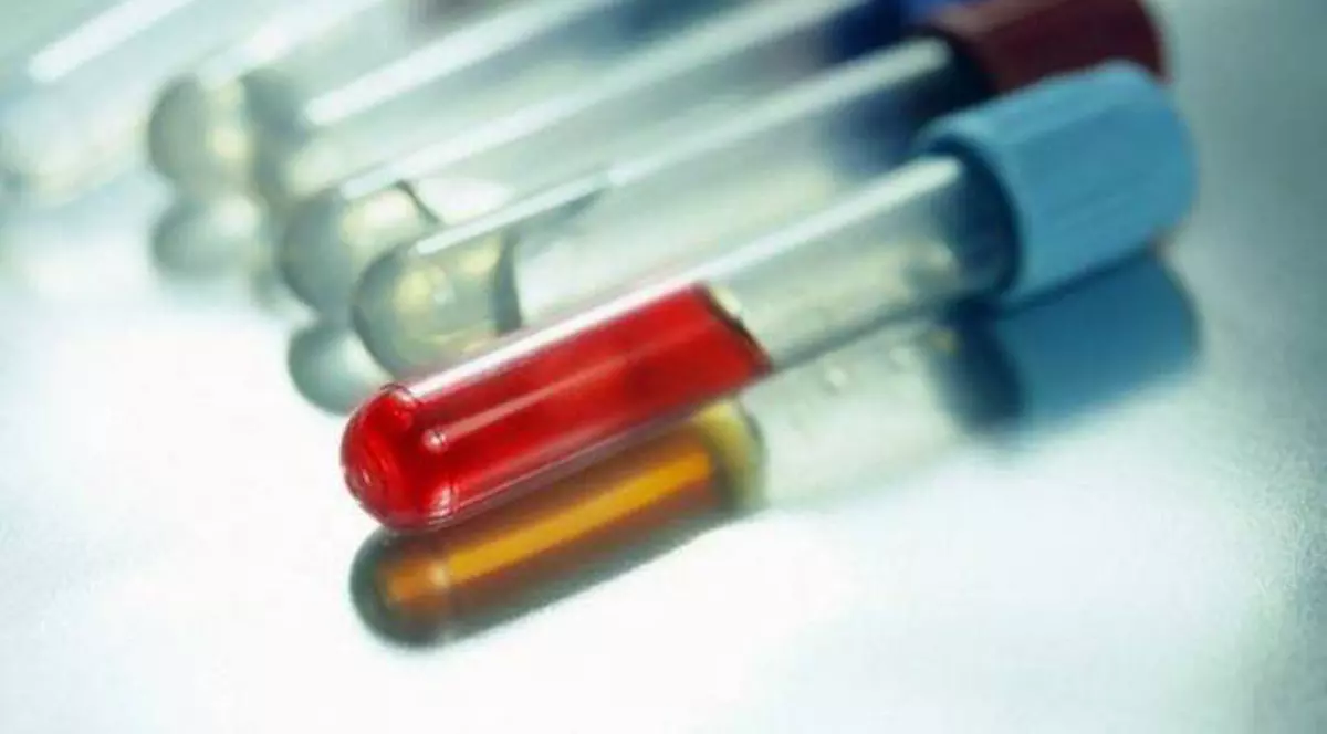 243 de români au fost diagnosticaţi cu HIV în primele şase luni ale anului