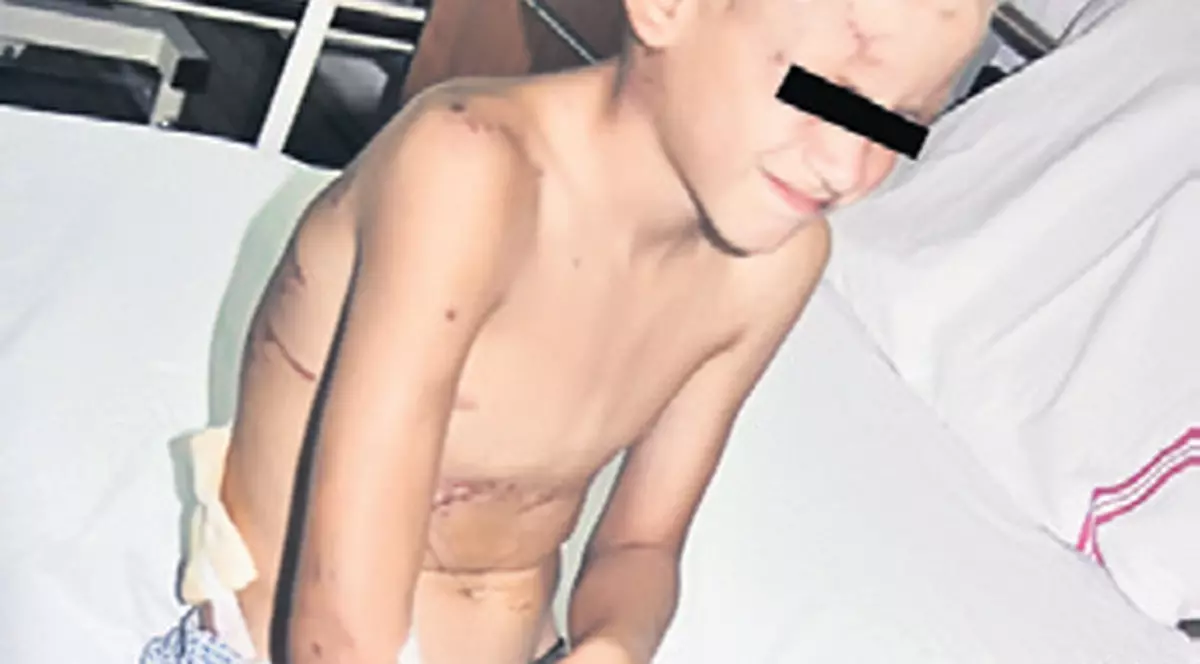 Copilul sfâşiat de câini are nevoie de psihologi ca să poată dormi noaptea