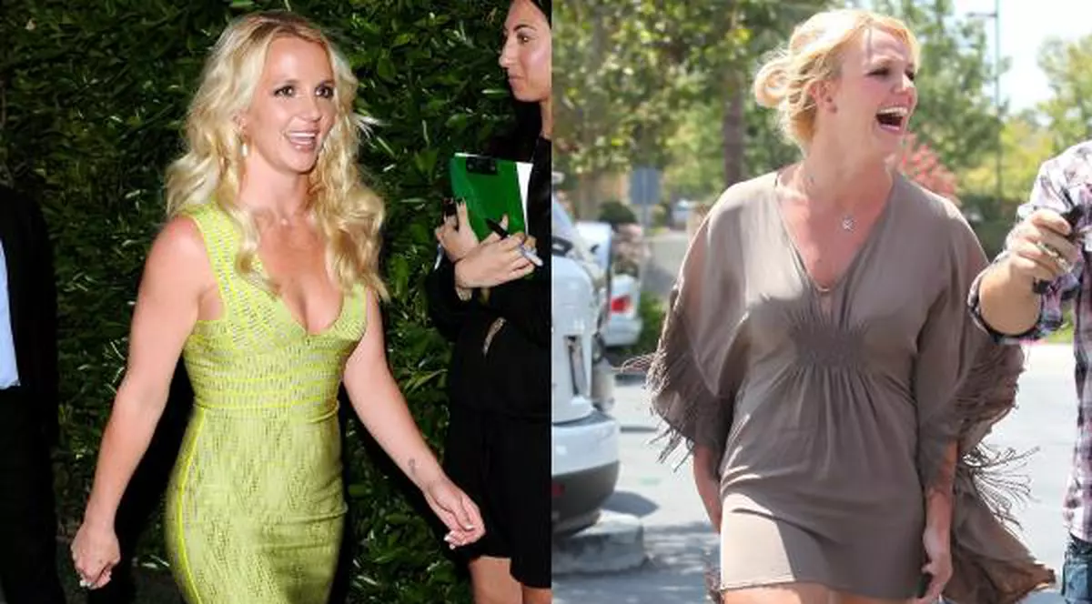 Trucuri de vedetă. Uite cine a slăbit prin liposucţie