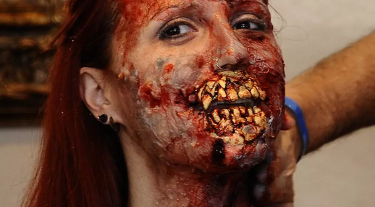 Foto şocant | Aşa arată o femeie desfigurată!