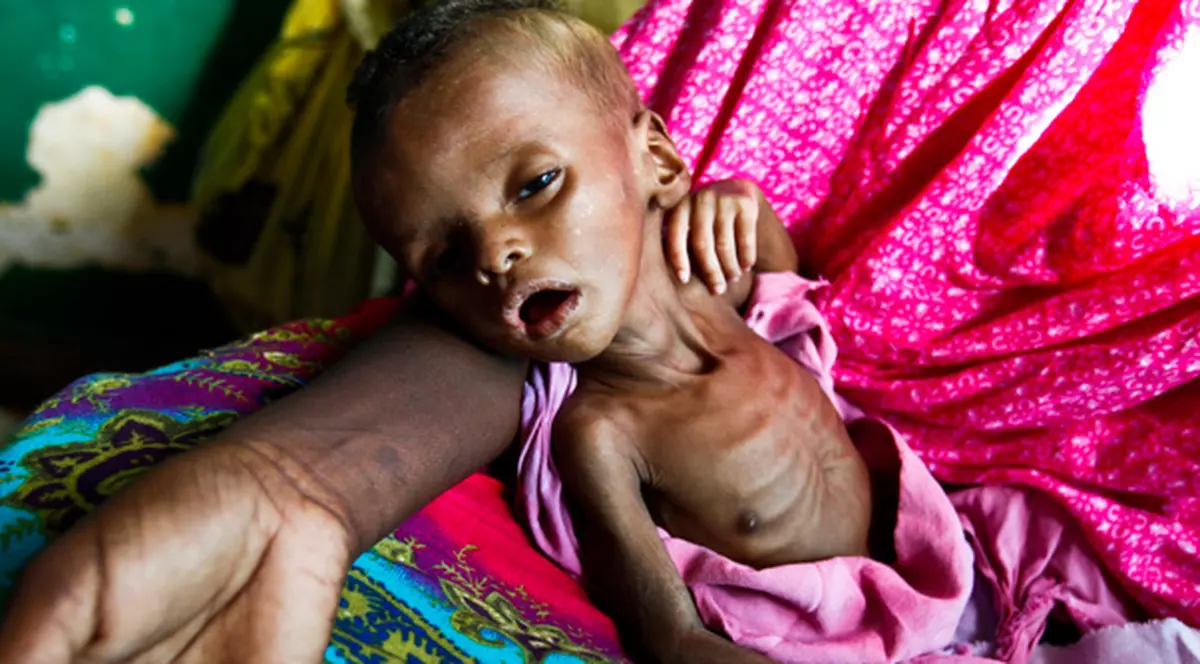 Noi imagini cutremurătoare din Somalia, unde zeci de copii mor zilnic de foame
