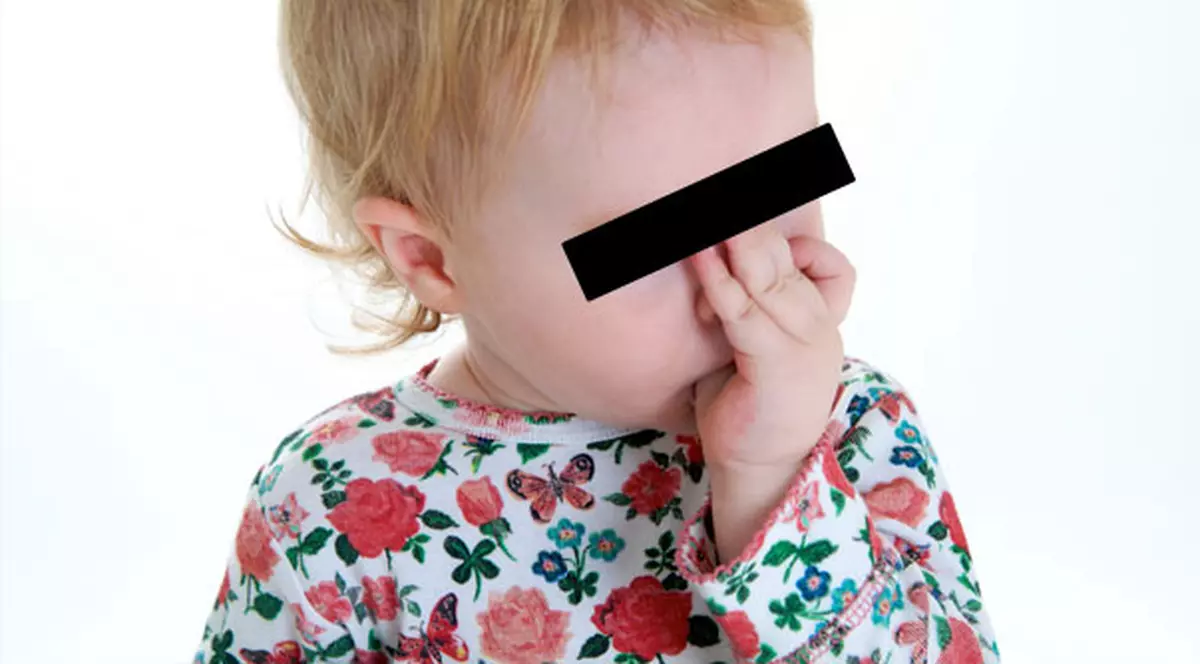 Ce fel de mame fac aşa ceva? Şi-a muşcat copilul de obraz!