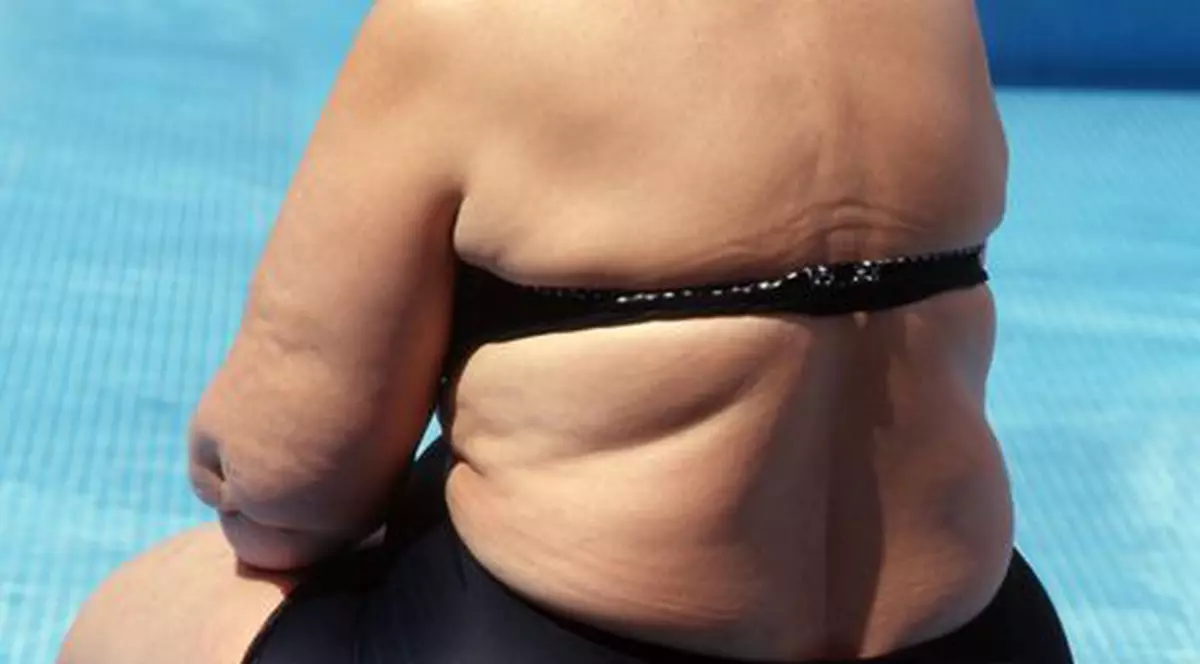 Iata cum poţi lupta împotriva obezităţii! Ore de gimnastică, apă la dozator şi reduceri fiscale