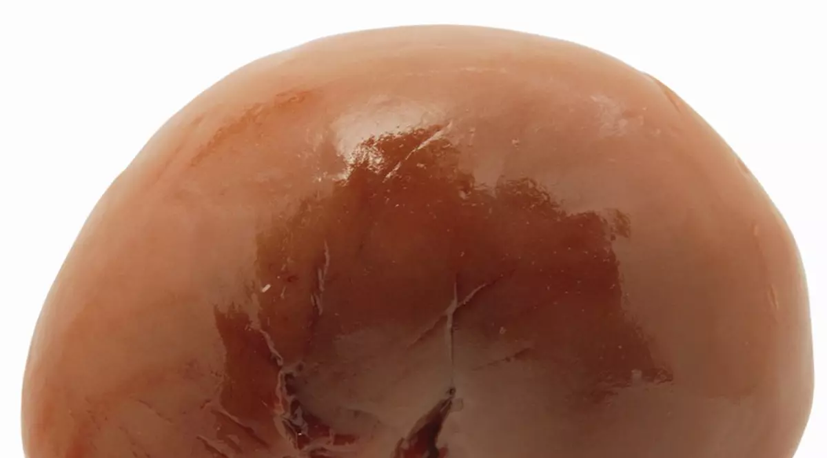 Șocant! Un român vrea să-și vândă un rinichi pentru a-și plăti ratele