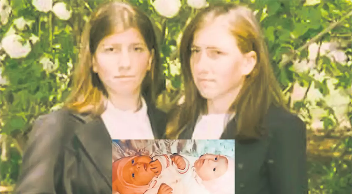 Medicul siamezelor Lina şi Gherghina mai încearcă o minune!