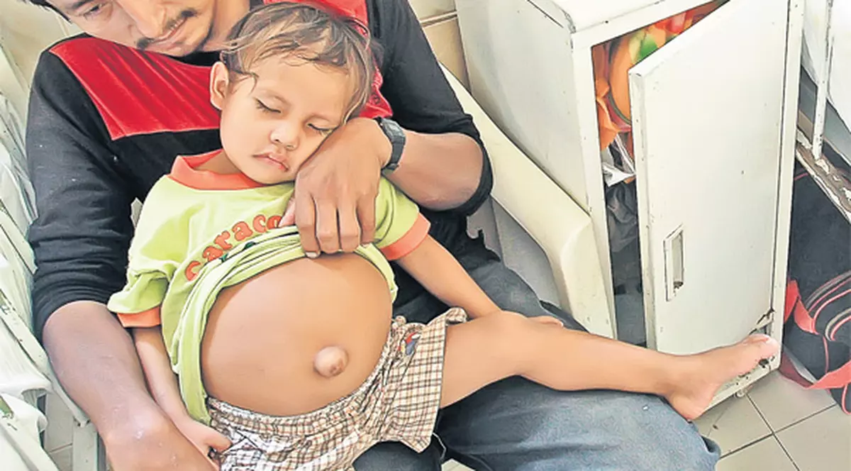 Un băieţel de 3 ani din Peru şochează cu malformaţia de care suferă: "Tati, eu de ce îl port pe frăţiorul meu în burtică?"