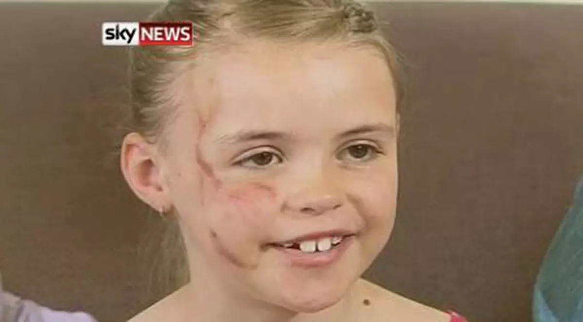 MOMENTE DE COȘMAR! O fetiță de 7 ani, ATACATĂ de un animal aparent inofensiv! Vezi despre ce este vorba! VIDEO