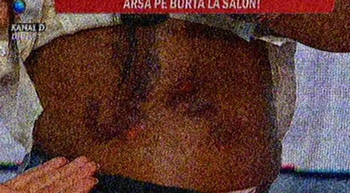 Vizita la salonul de înfrumusețare a costat-o scump! Laurette are carne vie pe burtă! FOTO