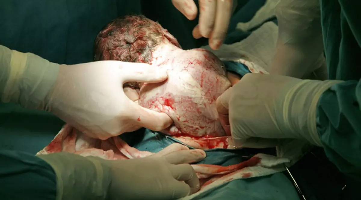 Ce gest şocant a făcut o moaşă când o femeie a născut un prunc mort