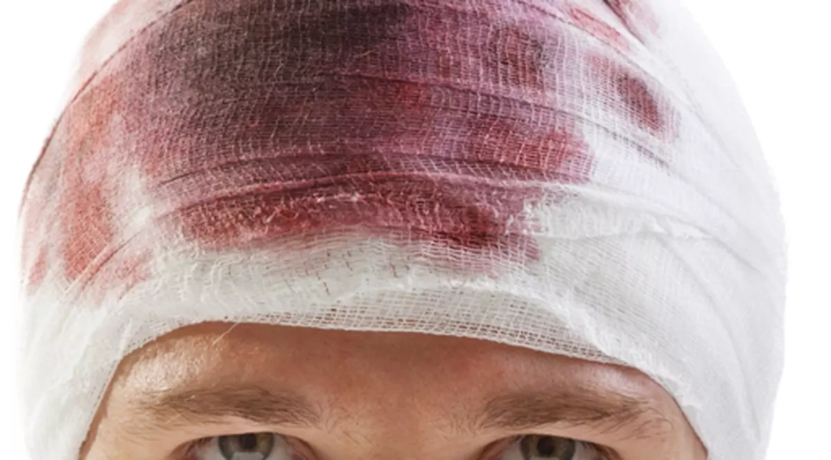 INCREDIBIL! A fost bătut de iubita lui de 1,55 m, iar acum își face operații estetice pentru ascunde cicatricile! Află povestea lui Ian McNicholl