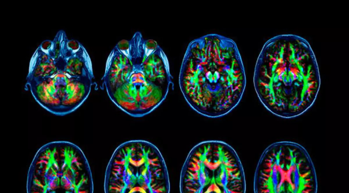 S-a dovedit științific! Dacă eşti dependent de internet, nu mai eşti om normal