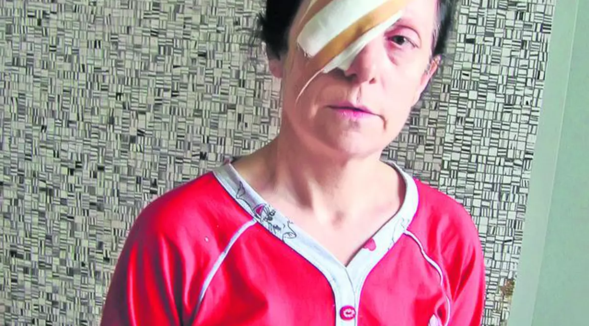 O asistentă din Galaţi a scăpat cu viaţă, însă a fost desfigurată de propriul soţ: «Mi-a aruncat cu acid pe faţă pentru că am vrut să divorţez»