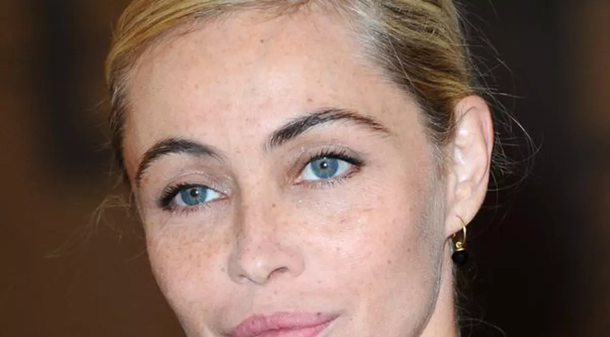 Una dintre cele mai frumoase femei din lume povestește calvarul prin care a trecut din cauza operațiilor estetice