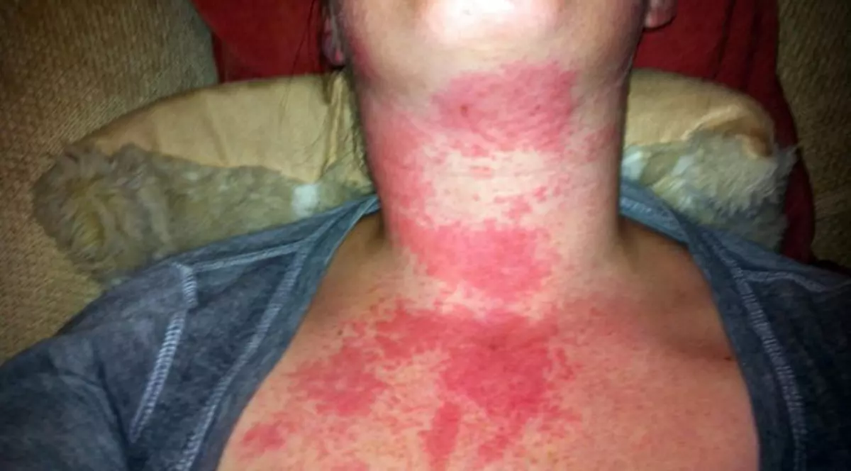 Tu îl foloseşti de zeci de ori pe zi, dar pe ea o poate omorî | FOTO