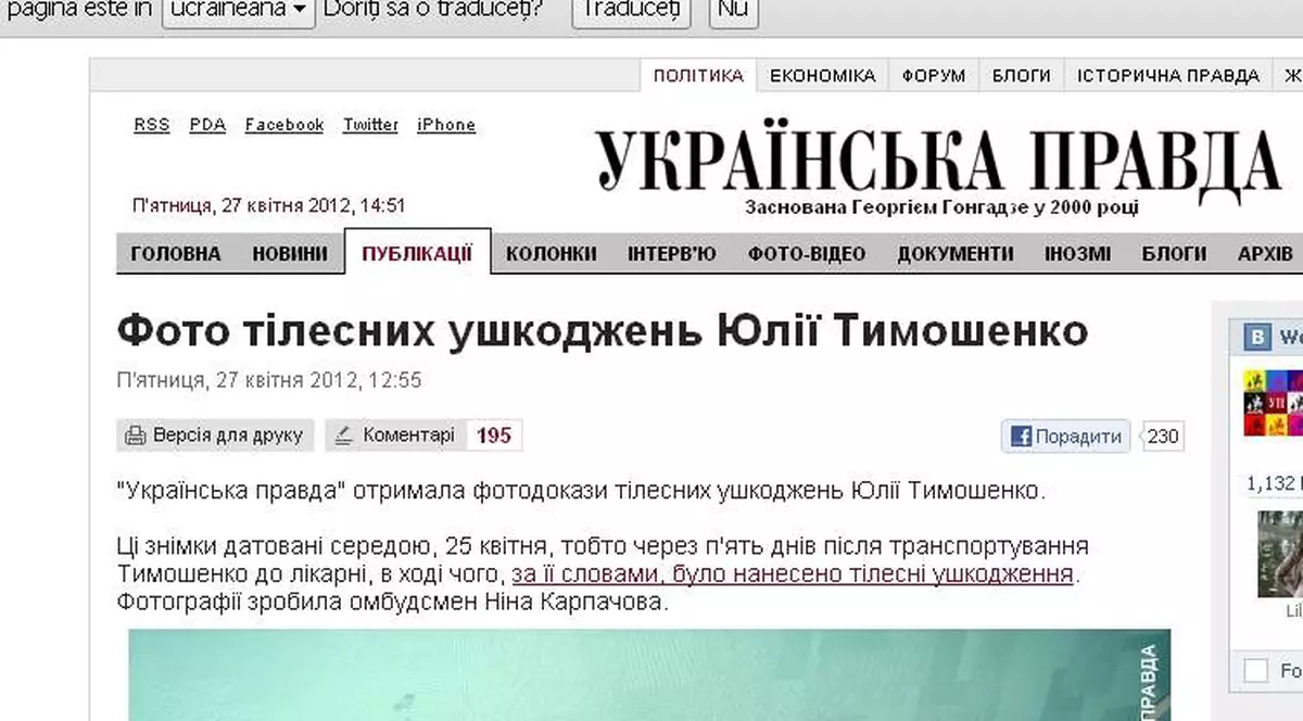 EXPLICAȚIA halucinantă pe care a dat-o conducerea închisorii despre vânătăile Iuliei Timoșenko 