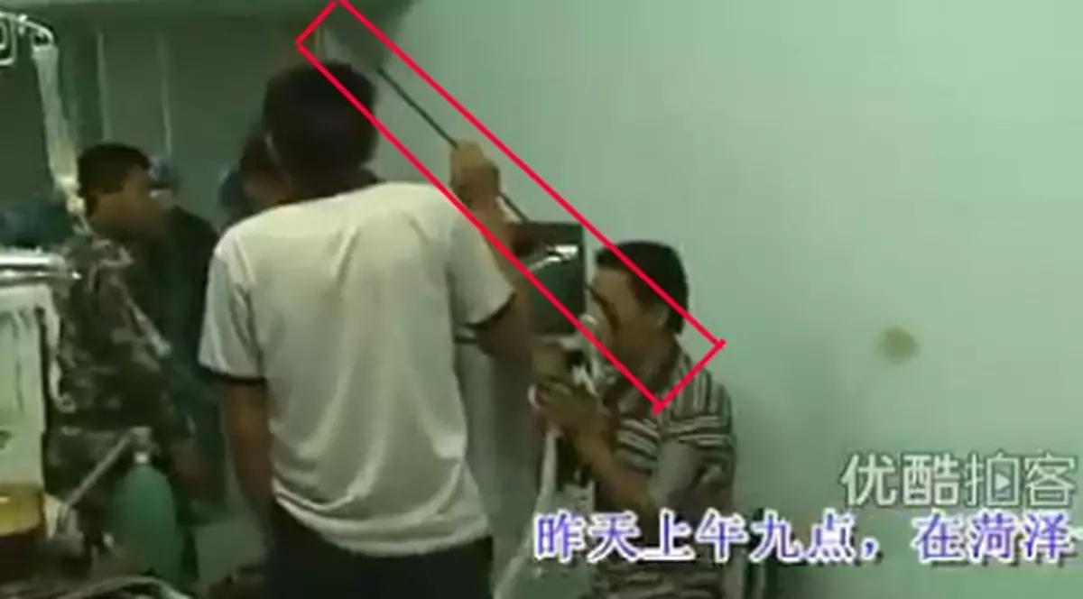 VIDEO ŞOCANT! I-a intrat în ochi o bară de oţel de lungă 2 metri