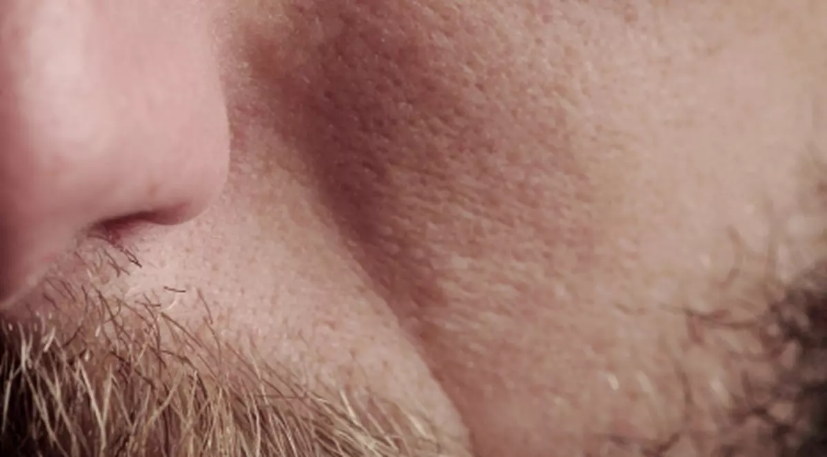 Şi-a BĂTUT UN CUI ÎN FRUNTE! Află ce a determinat un bărbat să recurgă la un asemenea gest 