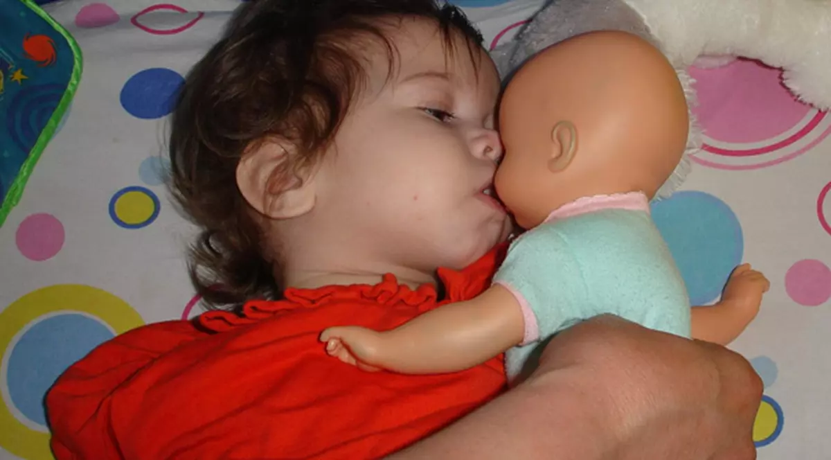 Îngeraş fără aripi! Delia s-a născut fără mâini şi fără picioare, iar părinţii ei au abandonat-o