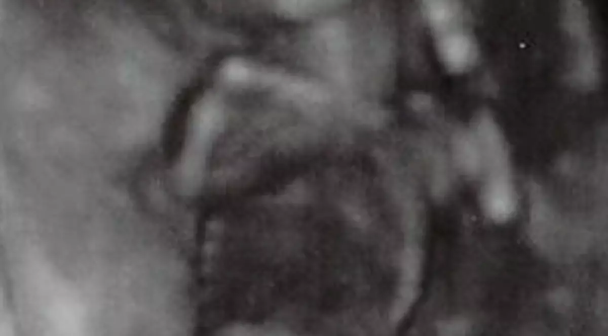 Momente de GROAZĂ la aeroport! Avea în bagaj CADAVRE PRĂJITE DE BEBELUŞI!