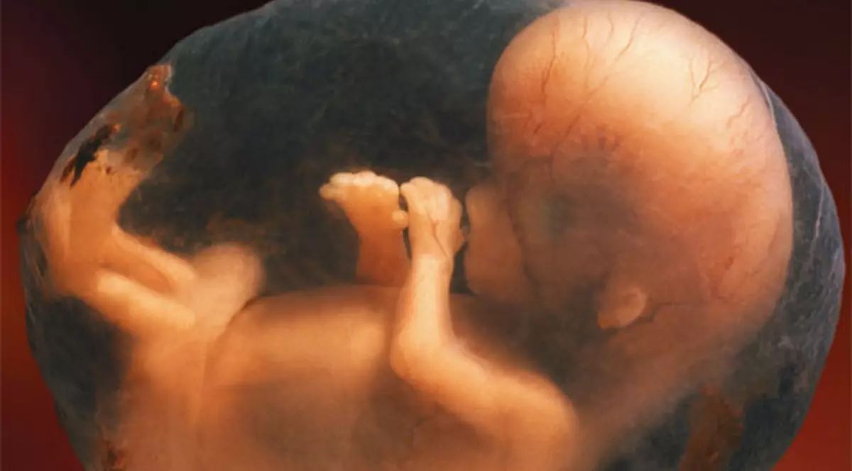 Un tailandez transporta fetuşi înveliţi în aur pentru ai folosi la magie neagră