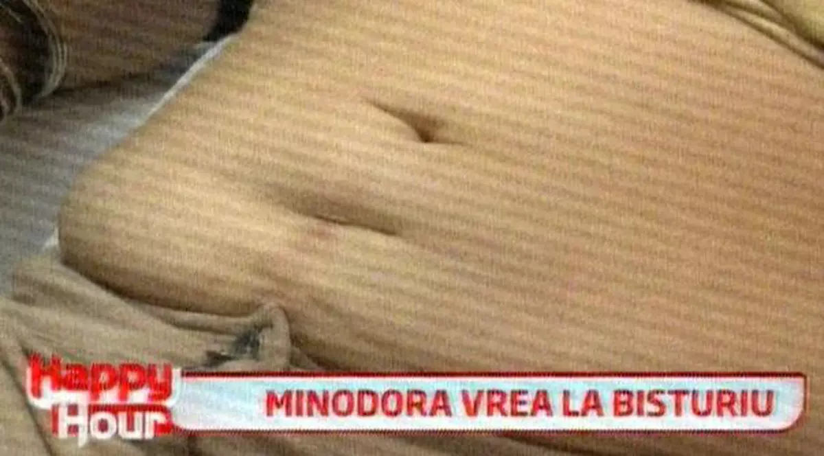 Minodora vrea să scape de burtă cu ajutorul bisturiului. Uite ce abdomen dizgrațios are!
