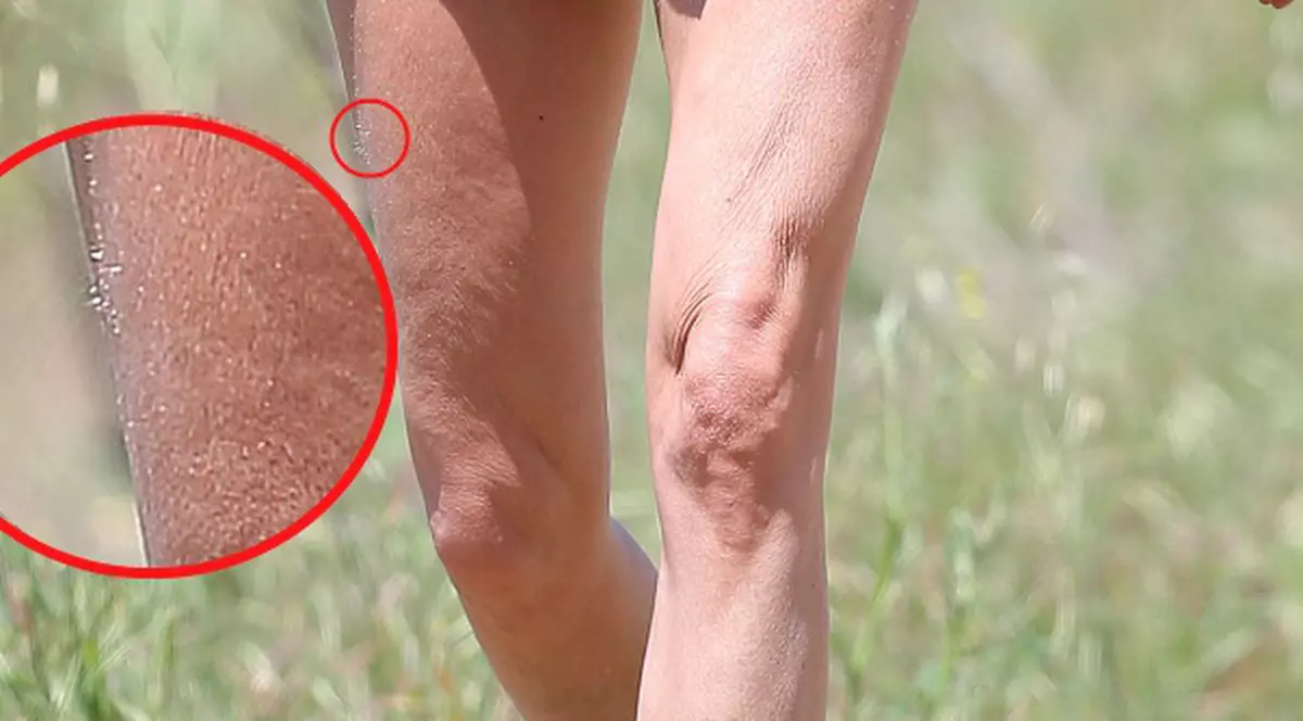 Picioare PĂROASE, SLABE şi RIDATE! O actriţă celebră arată horror fără photoshop! | FOTO