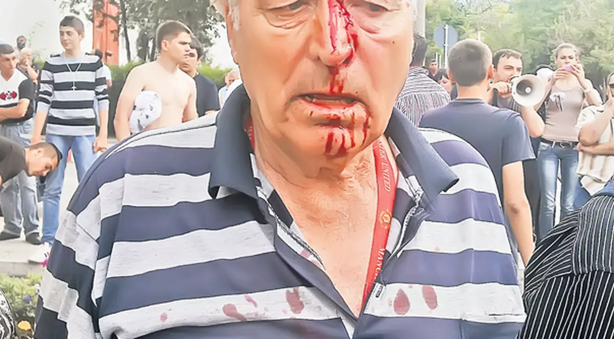 Un pensionar din Năvodari, snopit în bătaie de susţinătorii unui candidat