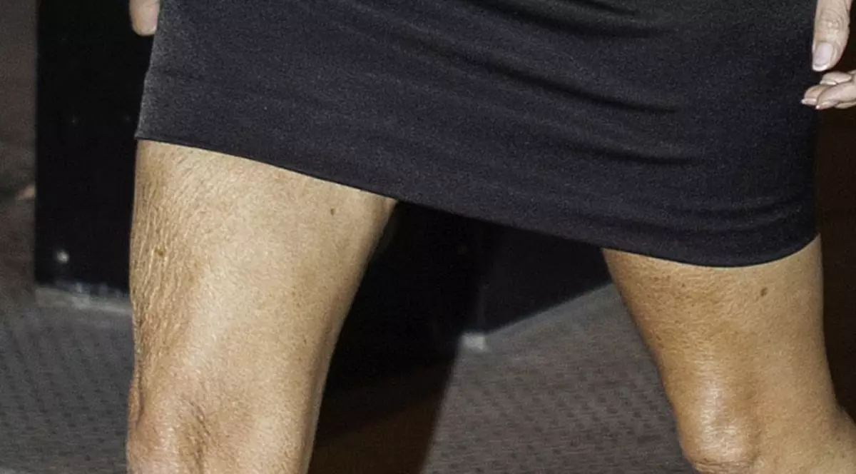 IMAGINE DE COŞMAR! Diva de la Hollywood pe care o adorai, cu PIELEA ZBÂRCITĂ pe picioare | FOTO INCREDIBIL