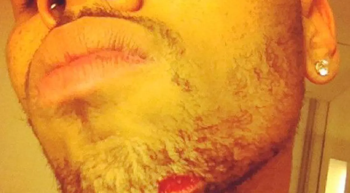 Bătaie ca în filme! Chris Brown, desfigurat de actualul iubit al Rihannei