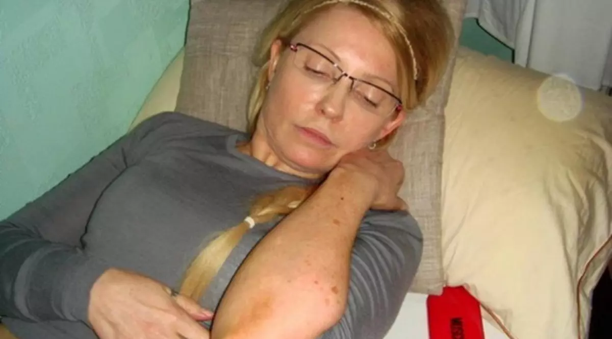 Iulia Timoşenko a contactat în închisoare o boală de piele necunoscută 