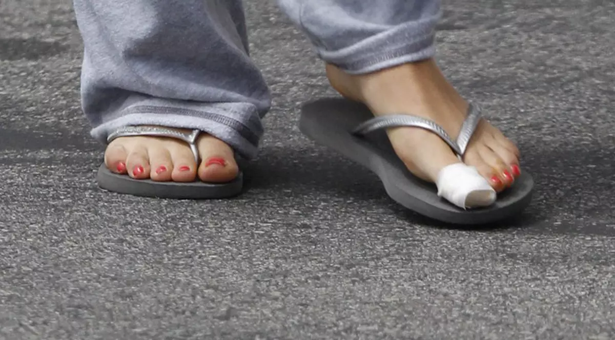 Americanii au făcut o nouă obsesie! Cea mai în vogă operaţie estetică: SUBŢIEREA DEGETELOR MARI de la picioare!