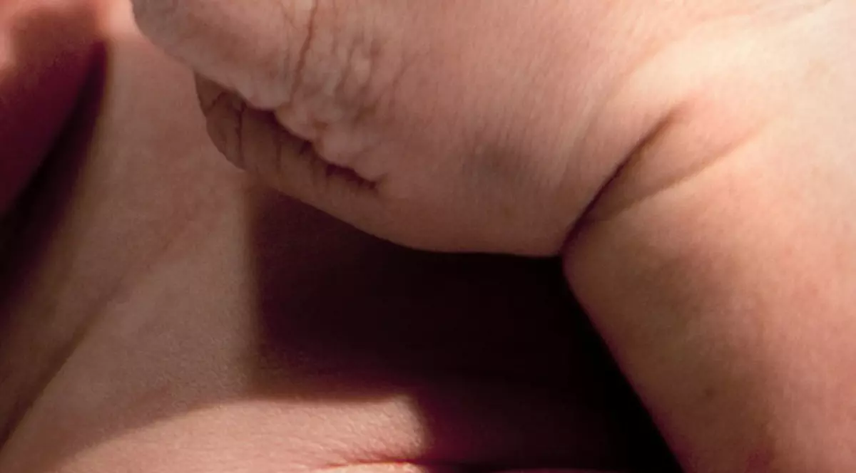 CAZ ŞOCANT! Comportamentul INCREDIBIL al unui bebeluş cu două capete