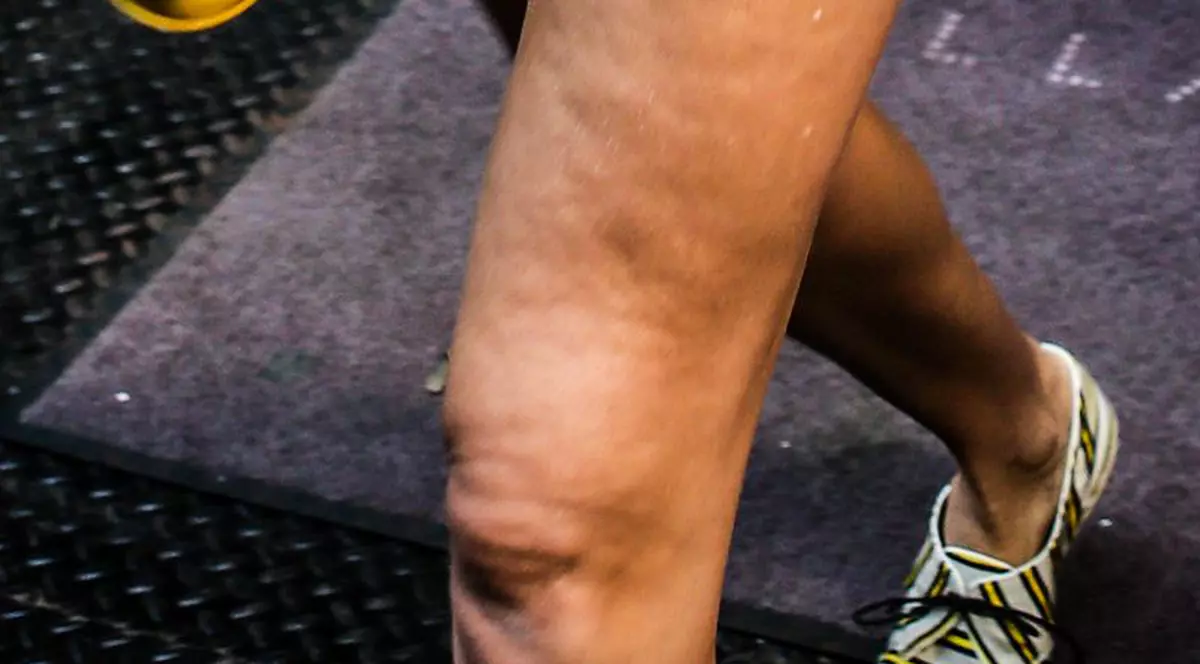 La banii ei, e INADMISIBIL! Vedeta IMPECABILĂ e, de fapt, un DEZASTRU. Defilează cu o celulită odioasă | FOTO