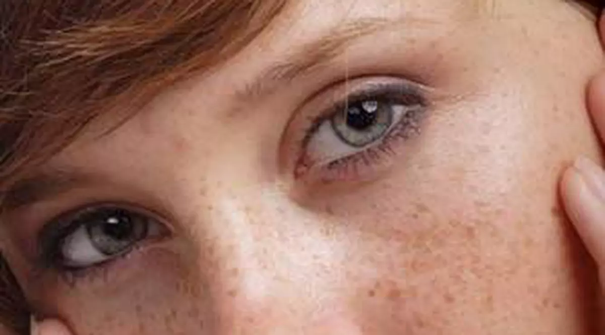 10 remedii naturale contra pistruilor