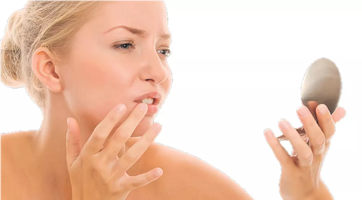 Ai herpes? Nu-l atinge, că se ia!