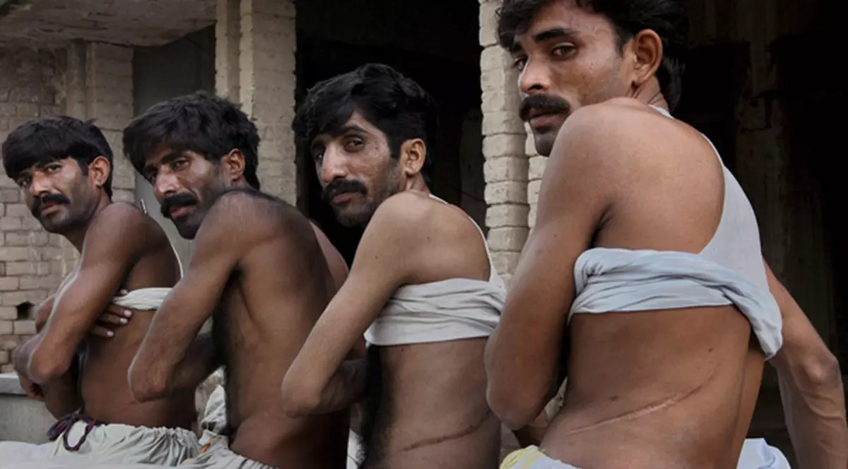 Ca să scape de sărăcie, îşi dau rinichiul pe 800 €