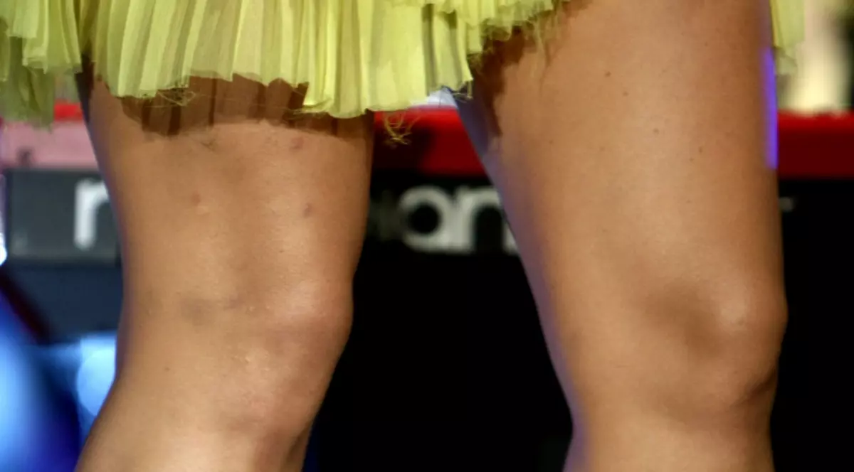 La valoarea ei, NU AVEA VOIE s-o comită! Cu BUBE PE PICIOARE şi ROCHIA RUPTĂ: aşa S-A FĂCUT DE RÂS, ÎN PUBLIC, o vedetă îndrăgită de la noi | FOTO