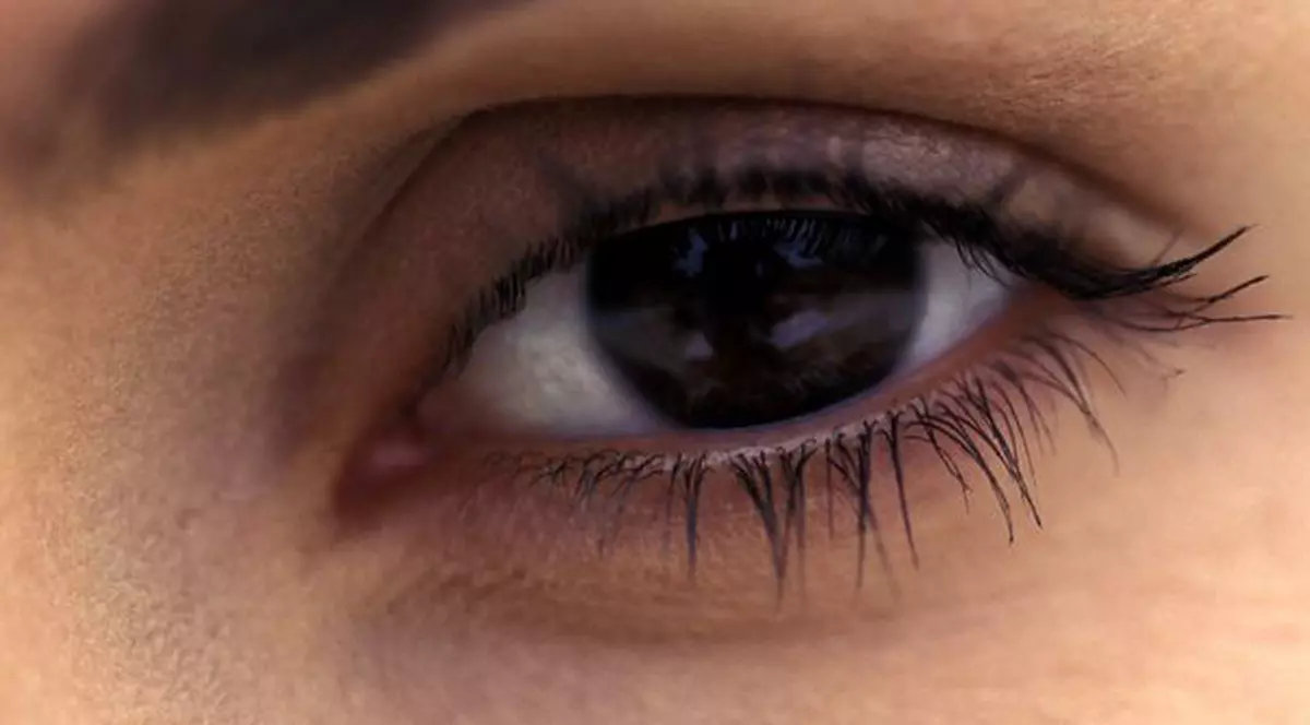 Persoanele cu ochi căprui riscă mai mult să se îmbolnăvească de vitiligo