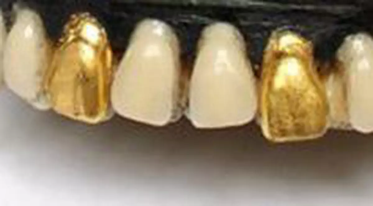 Se poate mai HIDOS? Pantofii cu DINȚI ”umani” AURIȚI | FOTO