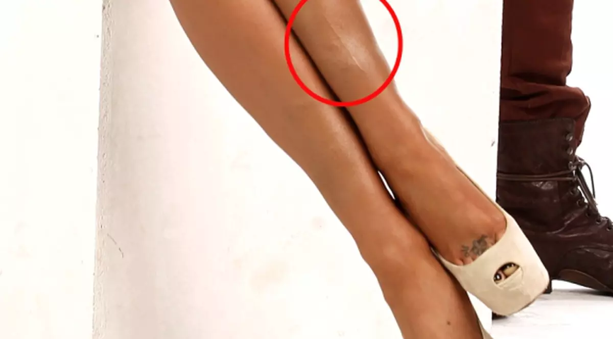 Bianca Drăguşanu, PLINĂ DE VÂNĂTĂI ŞI CICATRICI! Uite cum a apărut în poze | FOTO