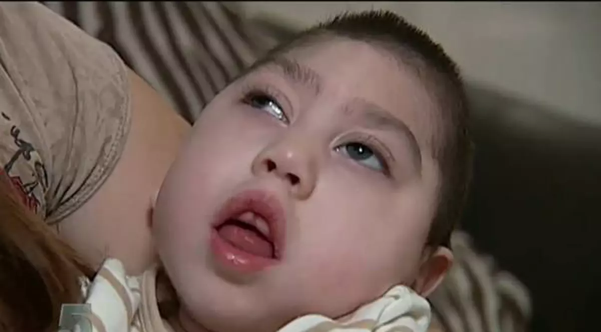 POVESTE LACRIMOGENĂ! Tragicul sfârşit al băieţelului născut fără creier