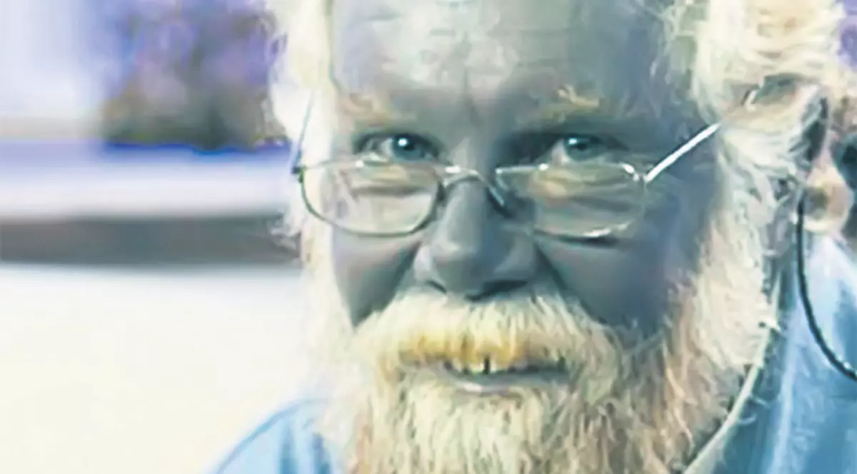 Atenţie! Substanţa care te transformă în ştrumf se vinde la liber