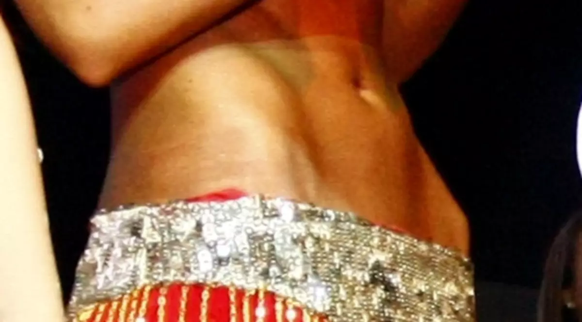 HORROR! O vedetă de la noi ŞOCHEAZĂ CU OASELE CARE ÎI IES PRIN PIELE | FOTO