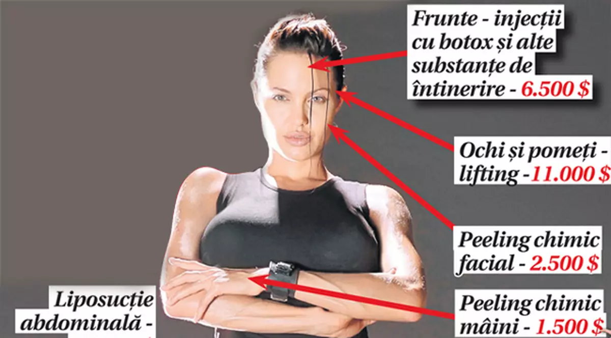 ANGELINA «SPARGE» 50.0000 $ pe operații estetice