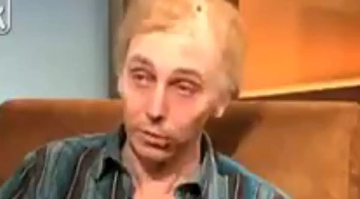 Un bărbat care a refuzat să accepte că are CANCER, MOARE ÎN DIRECT LA TV | Video