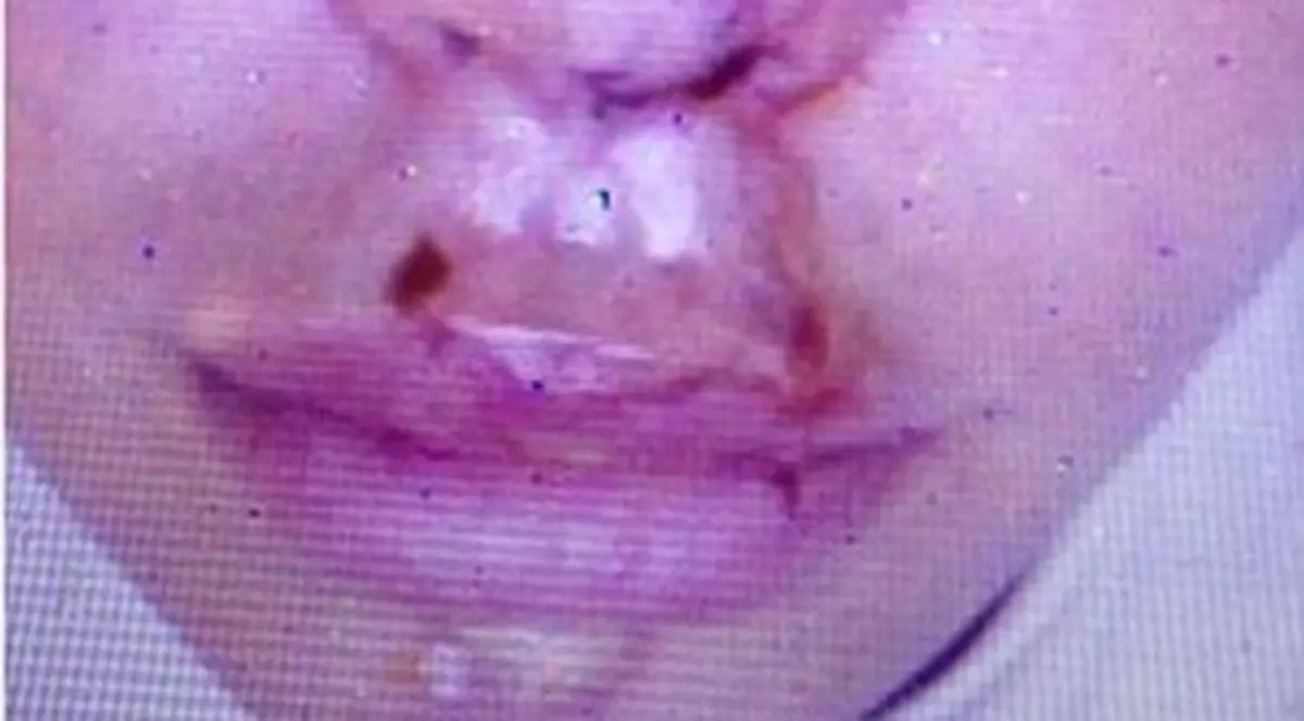 O vedetă si-a distrus faţa după un accident şi E FERICITĂ că a păţit-o! Vezi de ce!