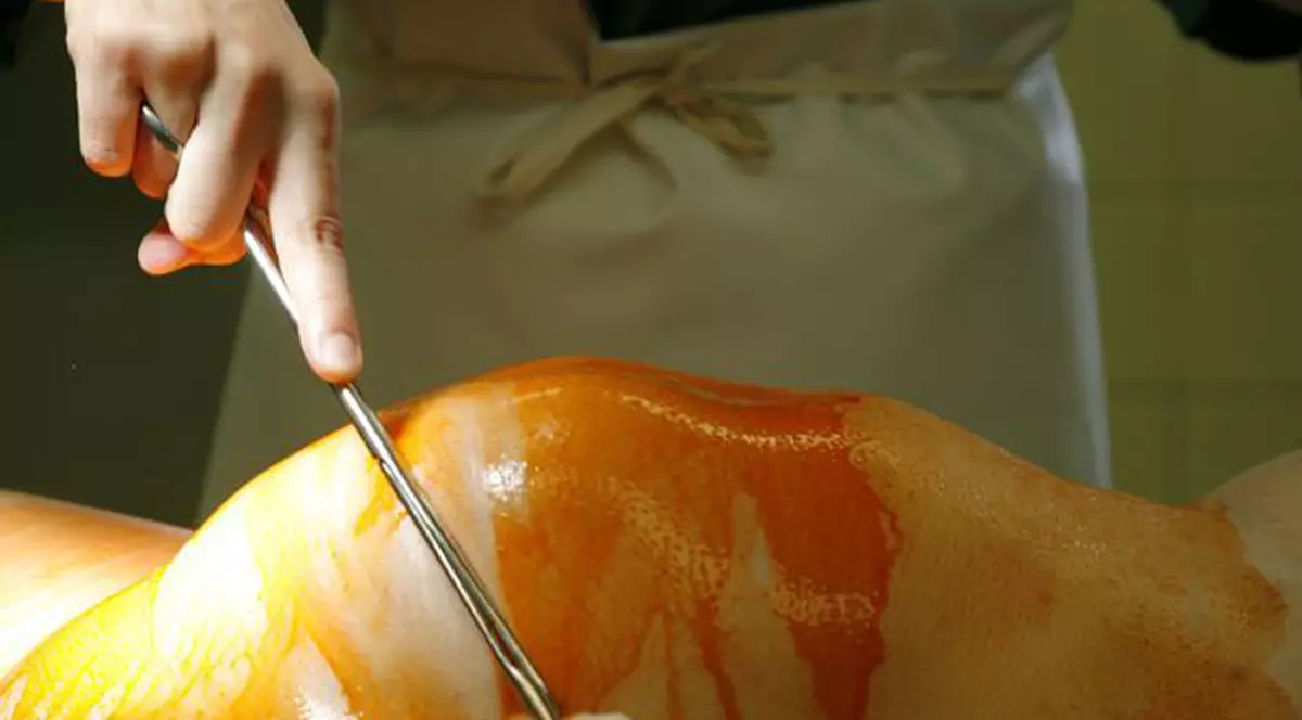 TRAGEDIE! Doi copii fără mamă! Tânăra care a intrat în comă la câteva zile după ce a născut A MURIT