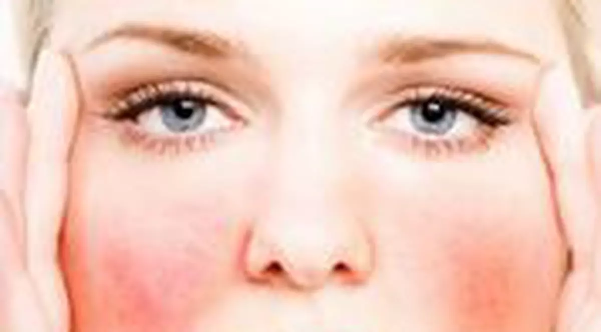 Cum ții cuperoza în frâu