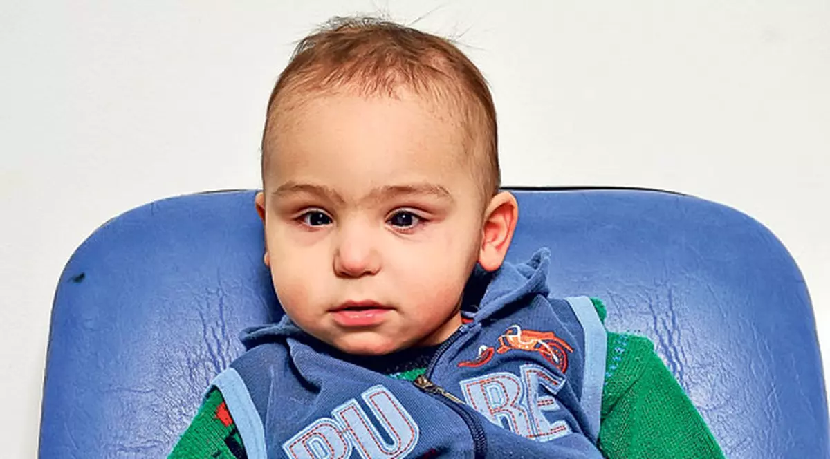 Darius, copilul pentru care curcubeul este negru